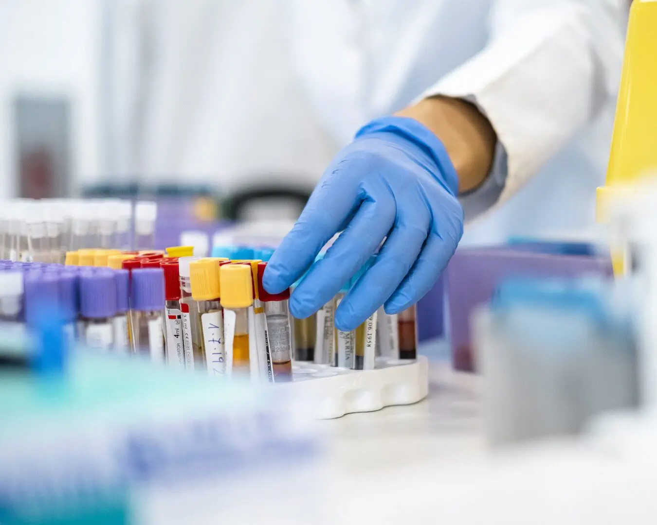 Laboratory technician arranging vials on table